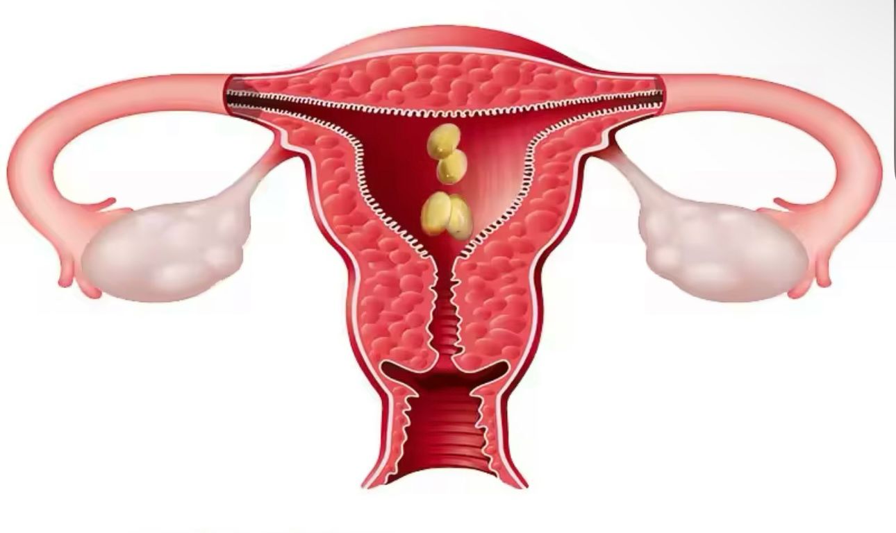 VIEJ Vagina Tightening Capsules