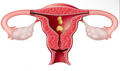 VIEJ Vagina Tightening Capsules